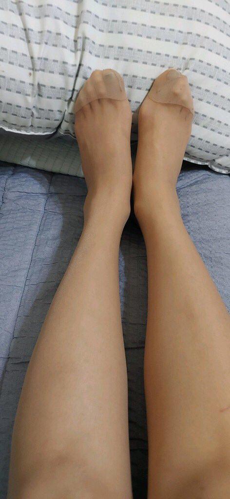 냄새나는 발