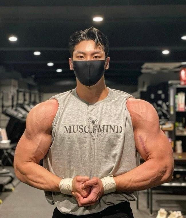 성형으로 인생이 바뀐 사람.jpg