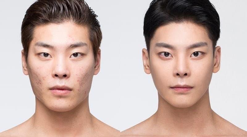 성형으로 인생이 바뀐 사람.jpg