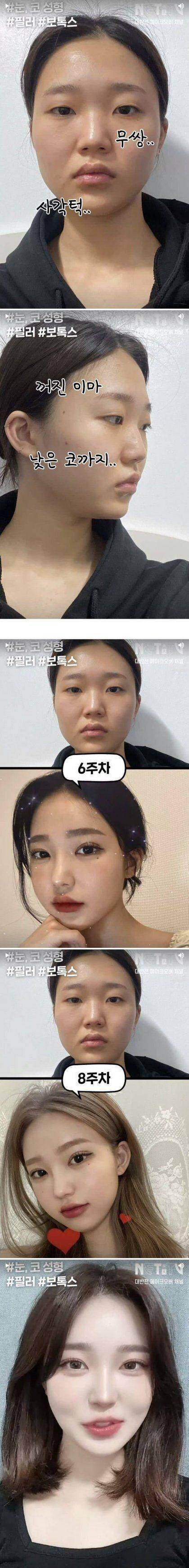 여자들이 죽어라 성형하는 이유