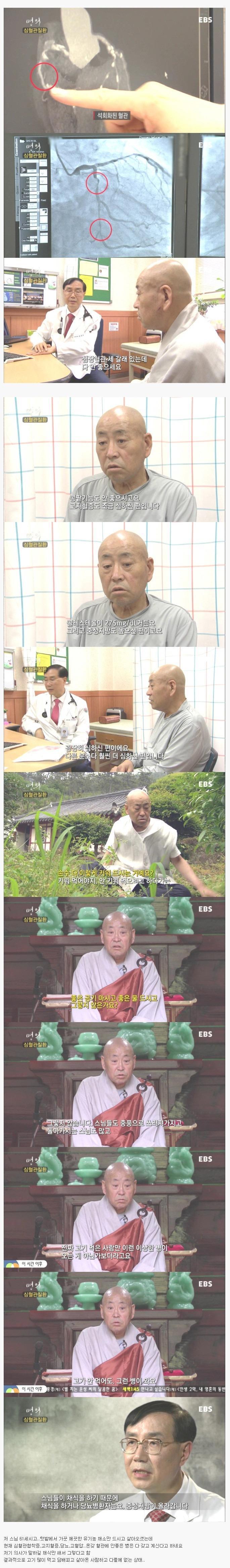 채식 스님 몸상태