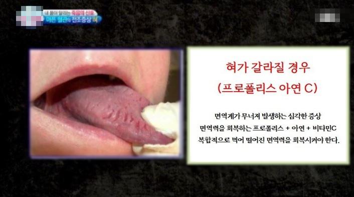 혀만 보면 다 알 수 있음
