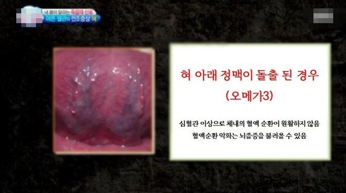 혀만 보면 다 알 수 있음