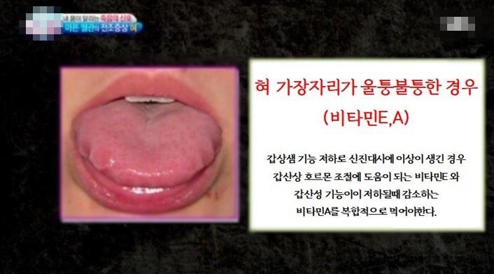 혀만 보면 다 알 수 있음