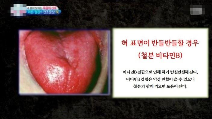 혀만 보면 다 알 수 있음