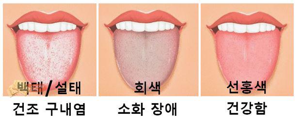 혀만 보면 다 알 수 있음