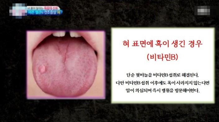 혀만 보면 다 알 수 있음