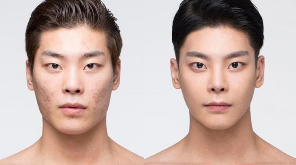 성형으로 인생이 바뀐 사람.jpg