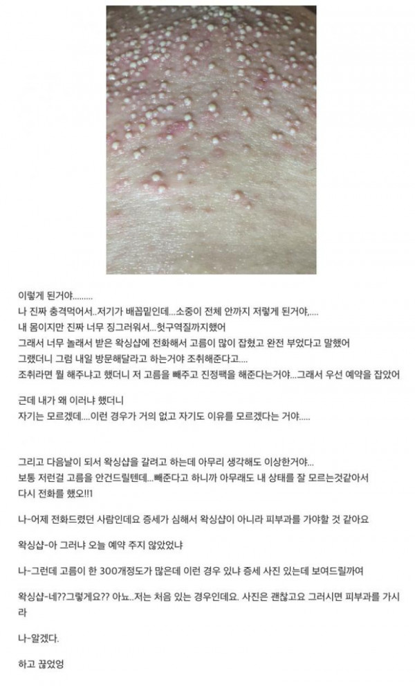혐)  어떤이의 왁싱 후유증