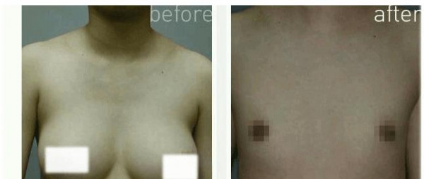 의사를 당황시킨 여유증 환자