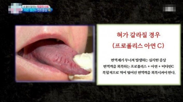 혀만 보면 다 알 수 있음