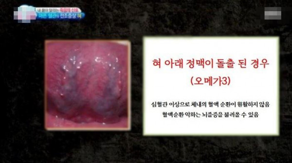혀만 보면 다 알 수 있음
