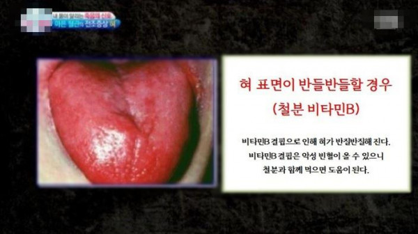 혀만 보면 다 알 수 있음